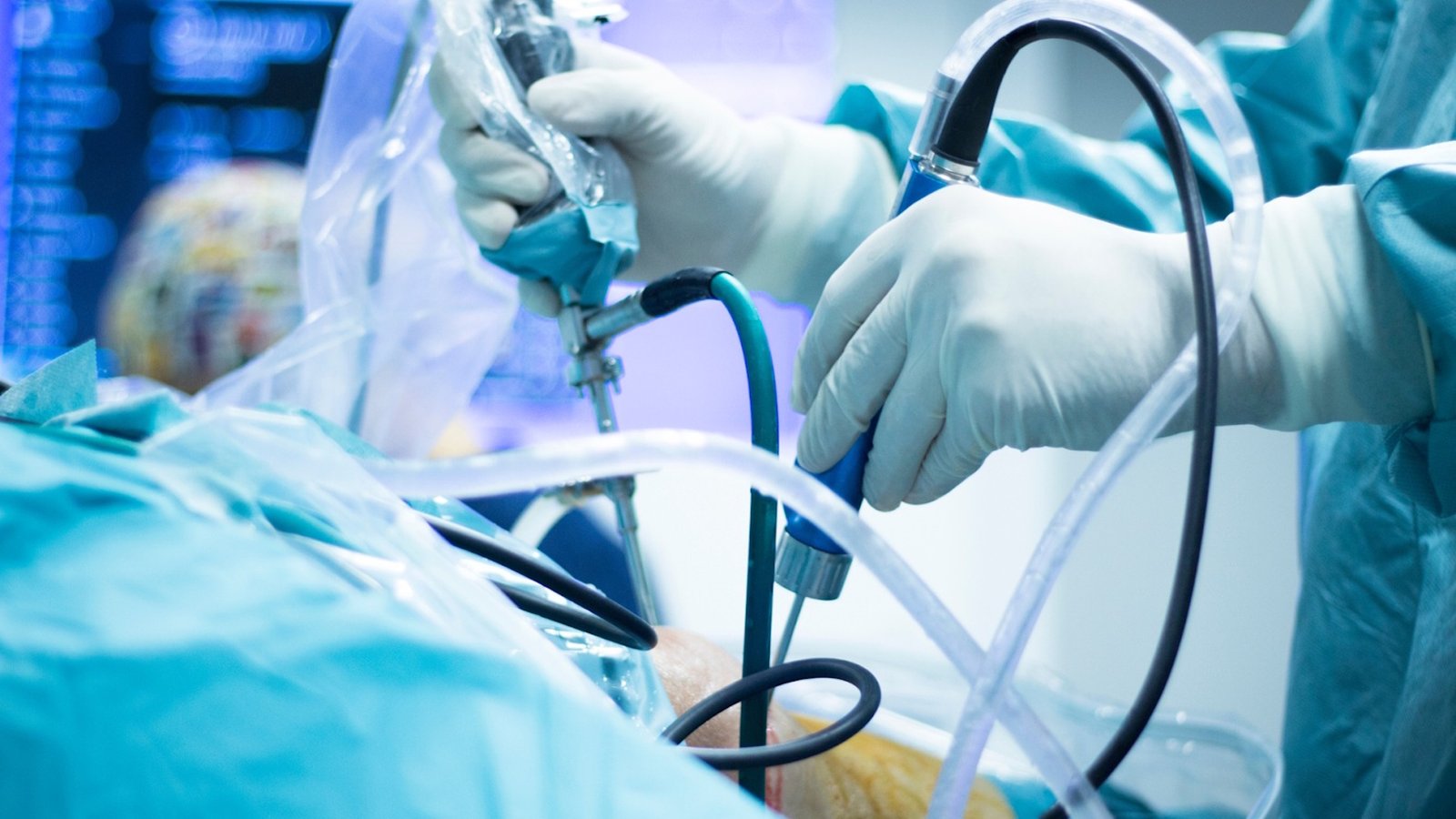 arthroscopy diagnosis arthroscopy diagnosis