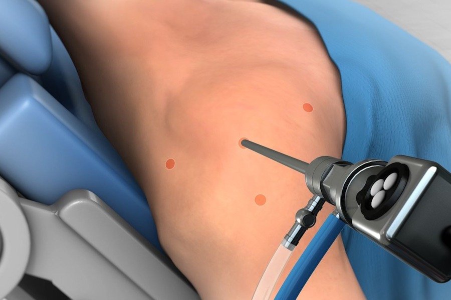 tsikouris diagnosticarthroshoulder