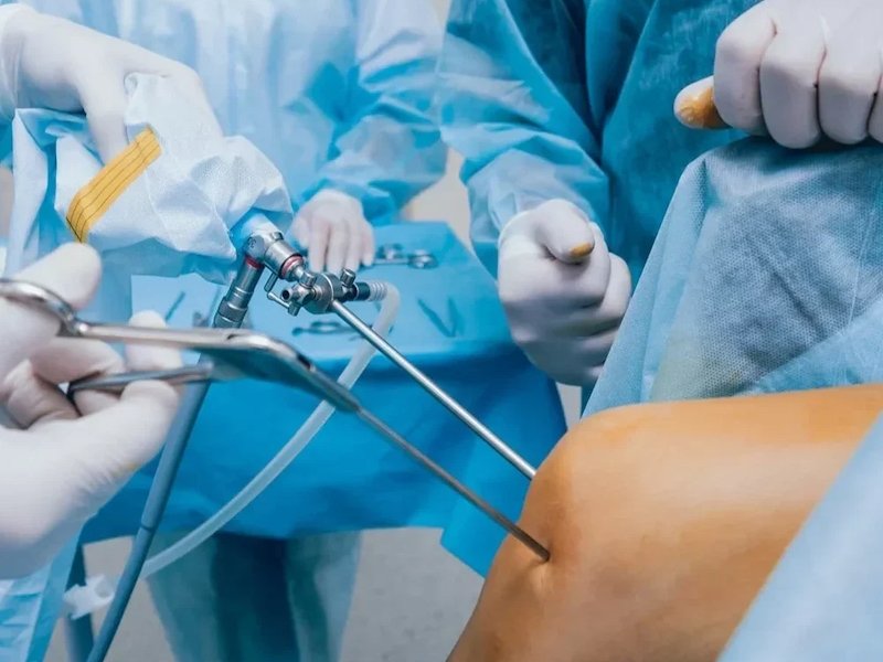 Ιατρείο tsikouris knee arthroscopy